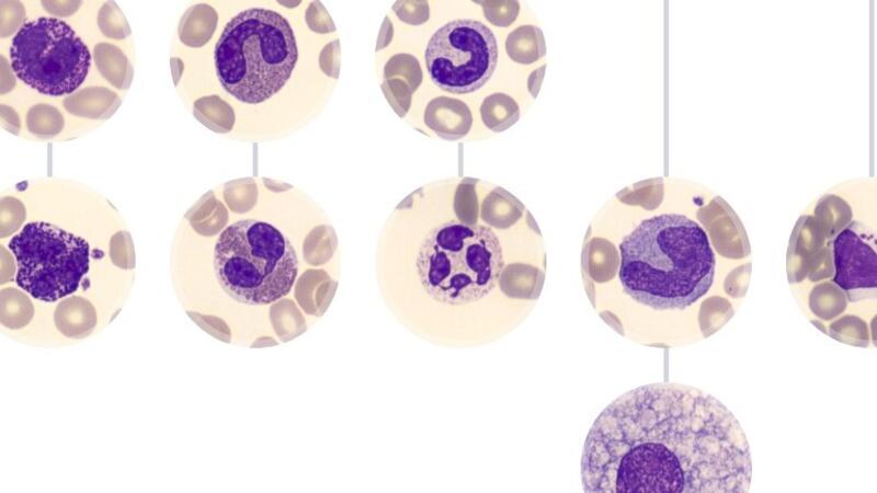 Hematologie