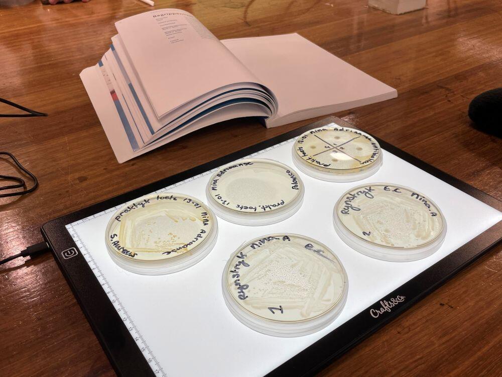 Vijf petrischaaltjes met bacteriën liggen op een tafel